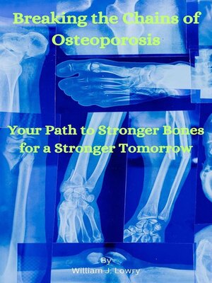 cover image of Breaking the Chains of Osteoporosis